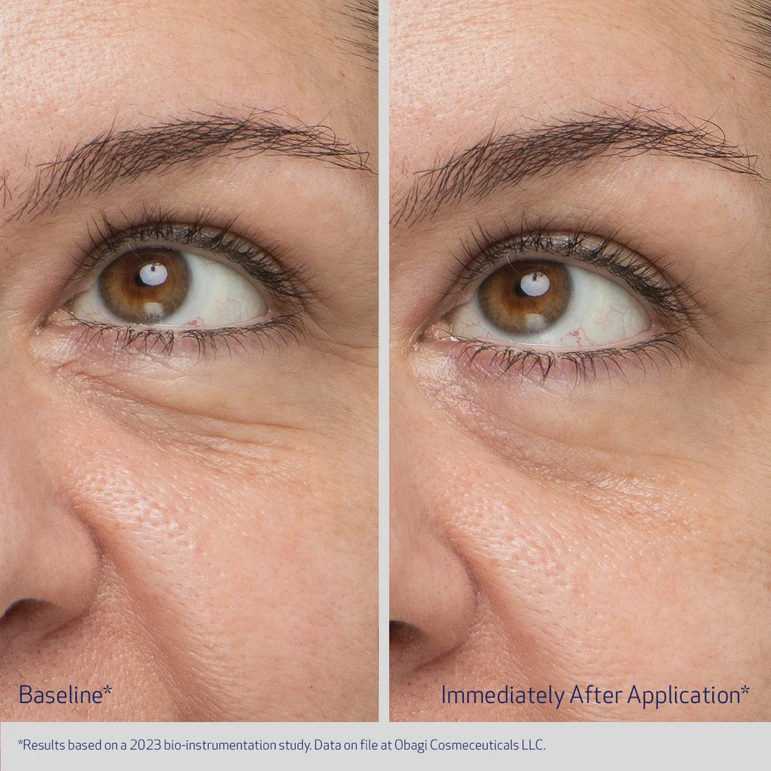 Obagi Daily Hydro Drops® Rejuvenating Eye Gel Cream